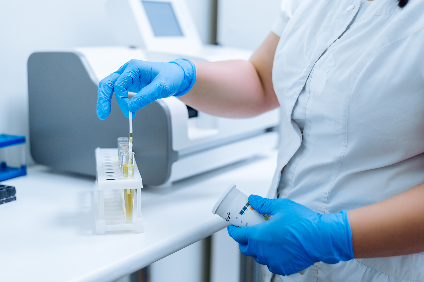 Lab worker holds in his hand a test for urine analysis.